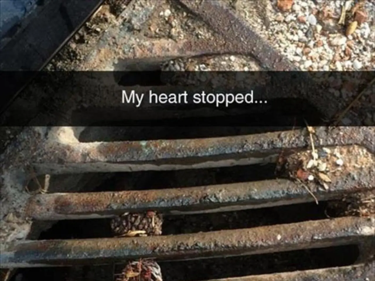 Detailed Exploration of Pacemakers: Their Workings and Importance