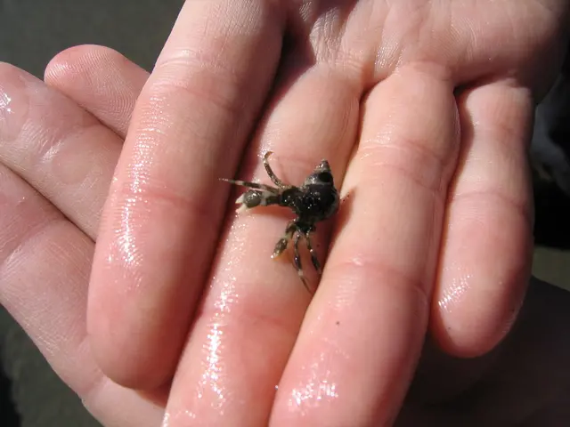 Hand Pimple: Reasons and Remedies