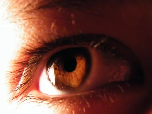 Under-eye bags: Causes, identification, and remedies