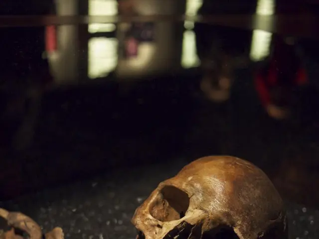 Subcortical white matter limited diffusion and eye muscle wastage observed in Kearns-Sayre syndrome...