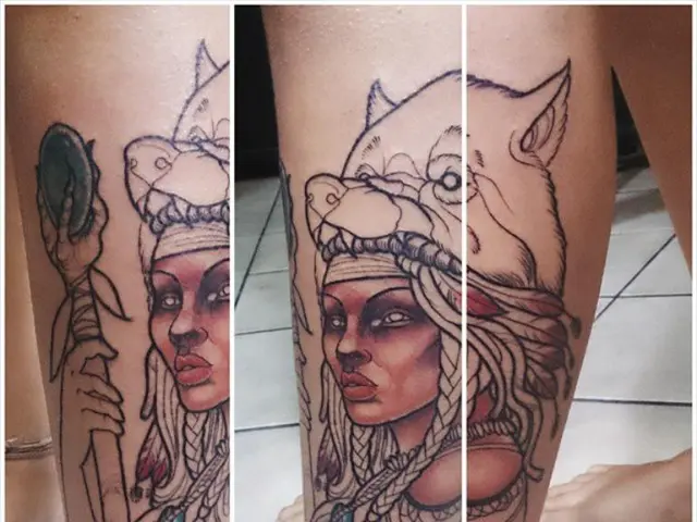 Expanded Enzymatic Debridement Market Revenue Projected to Reach USD 1,549.2 Million by 2034,...