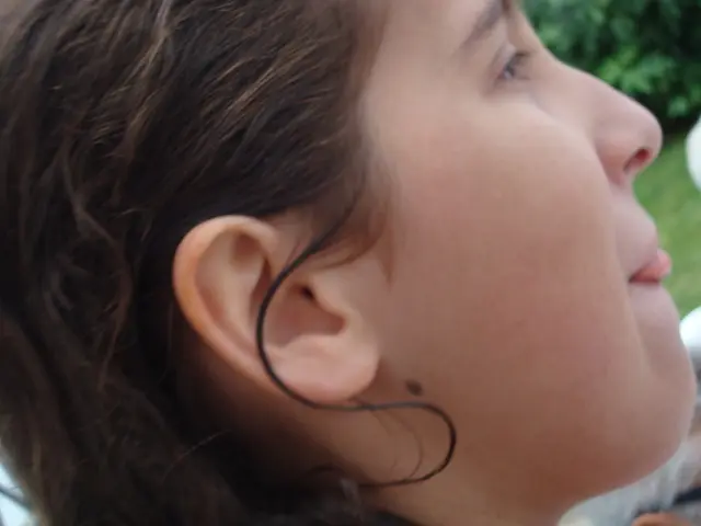 Squamous Cell Carcinoma: Insights into Causes, Therapies, and Further Information