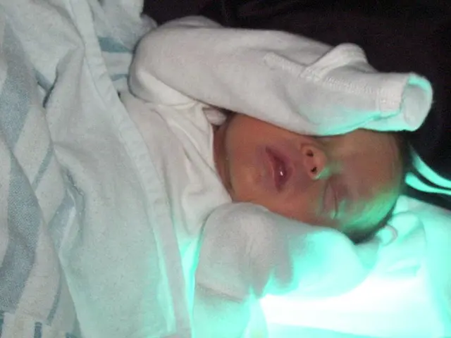 Drastic Brain Alterations During Pregnancy Unveiled!