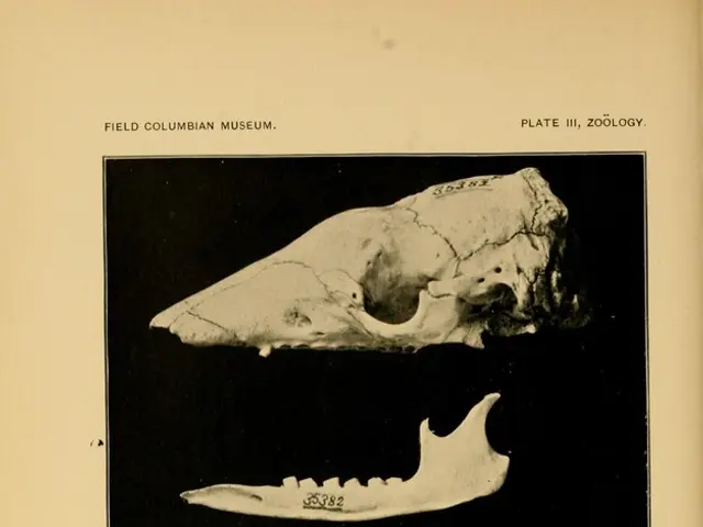 Sole Plasmacytoma: An explanation of its nature, triggers, and outlook