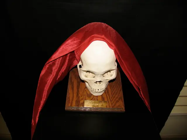 Colombian Senator Miguel Uribe is gravely ill due to a severe hemorrhage.