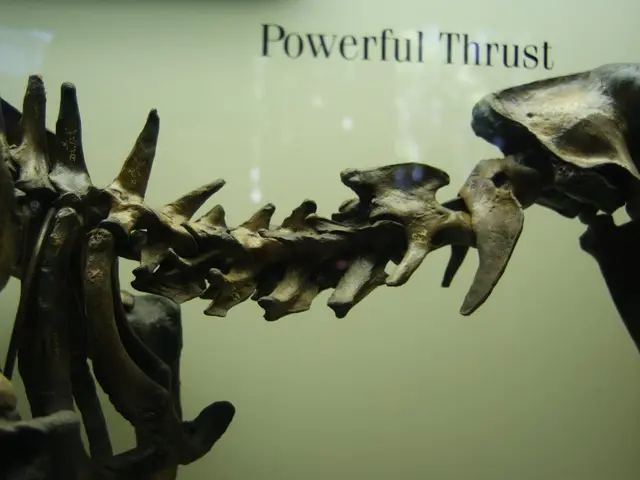 Differences and Insights Between Spinal Muscular Atrophy and Spina Bifida