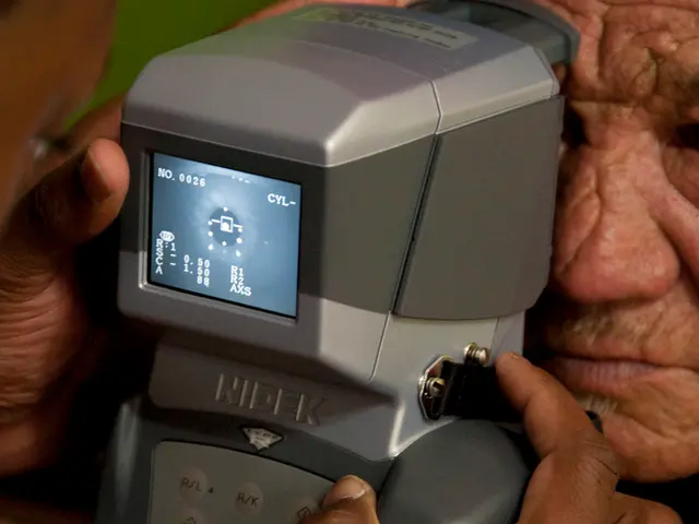 Diabetic Retinopathy in its advanced stage, characterized by abnormal blood vessel growth in the...